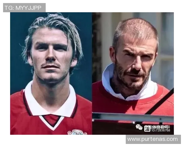 足球明星植发失败引发热议背后真相曝光令人唏嘘不已